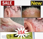 Health Care Psoriasis Cream Eczema Ointment Scalp Hand Tinea Foot 15G. Fixed Price $8.85.